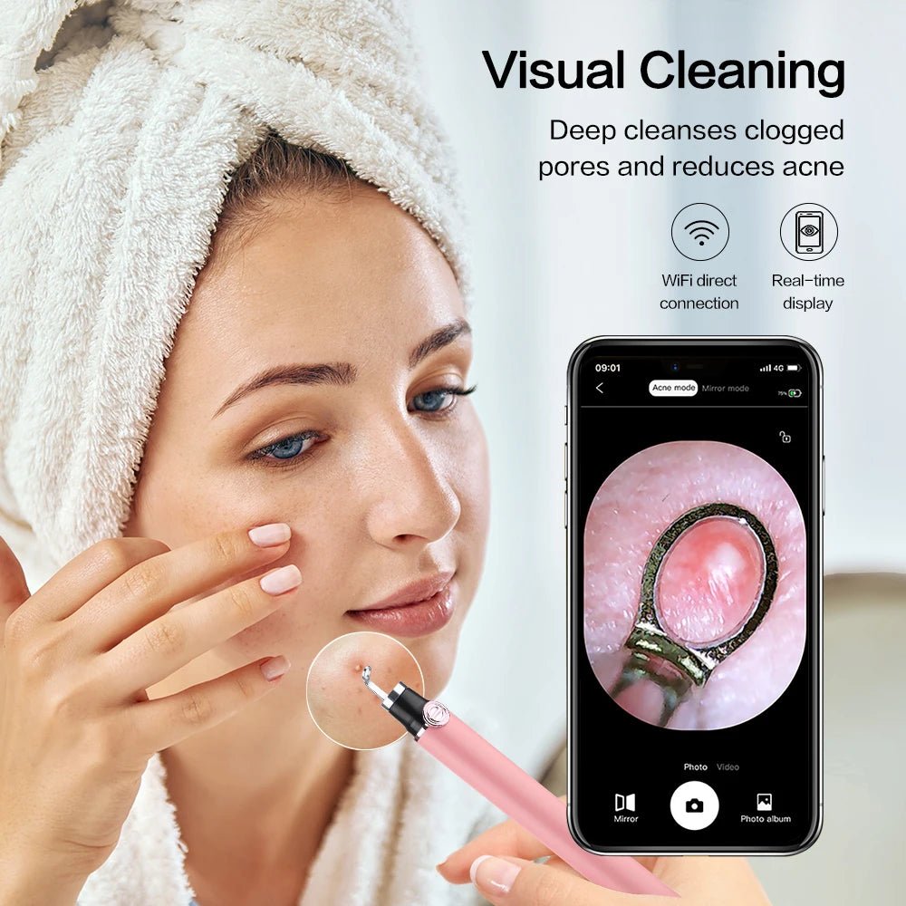 Blackhead Remover & Acne Cleaner With Camera - Alumis