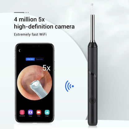 Ear Wax Removal Tool With Camera - Alumis